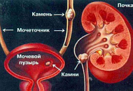 Трава птичий горец - применение при мочекаменной болезни