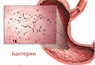 Профилактика гастроэнтерита у детей и взрослых Профилактика гастроэнтерита у детей и взрослых
